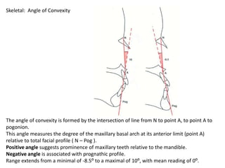 Skeletal: Angle of Convexity

The angle of convexity is formed by the intersection of line from N to point A, to point A t...