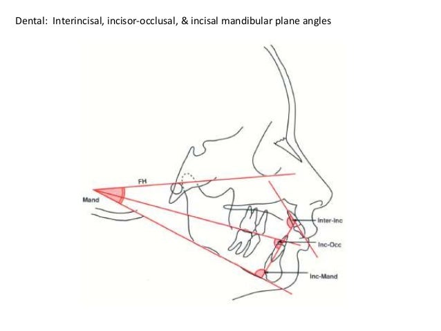 cephalometric analysis cephalometric analysis