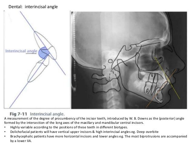 cephalometric analysis cephalometric analysis