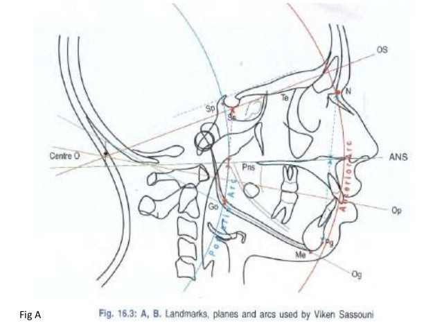 cephalometric analysis cephalometric analysis