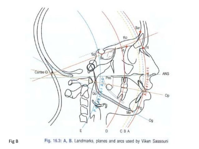 cephalometric analysis cephalometric analysis