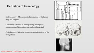 Ceph analysis for A-P dysplasia.pptxcephalometric | PPTX