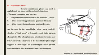 ceph_LLP_SEMINAR[2].pptx landmarks lines and planes | PPTX