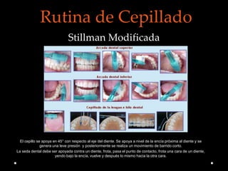 Rutina de Cepillado
Stillman Modificada
El cepillo se apoya en 45° con respecto al eje del diente. Se apoya a nivel de la encía próxima al diente y se
genera una leve presión y posteriormente se realiza un movimiento de barrido corto.
La seda dental debe ser apoyada contra un diente, frota, pasa el punto de contacto, frota una cara de un diente,
yendo bajo la encía, vuelve y después lo mismo hacia la otra cara.
 