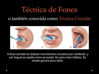 Técnica de Fones
o también conocida como Técnica Circular
A boca cerrada se realizan movimientos circulares por vestibular, y
por lingual se cepilla como se pueda. Es para crear hábitos. Es
simple genera poco daño.
 