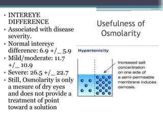 • INTEREYE
  DIFFERENCE                  Usefulness of
• Associated with disease
  severity.                    Osmolarity
• Normal intereye
  difference: 6.9 +/_ 5.9
• Mild/moderate: 11.7
  +/_ 10.9
• Severe: 26.5 +/_ 22.7
• Still, Osmolarity is only
  a mesure of dry eyes
  and does not provide a
  treatment of point
  toward a solution
 