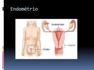 Endométrio