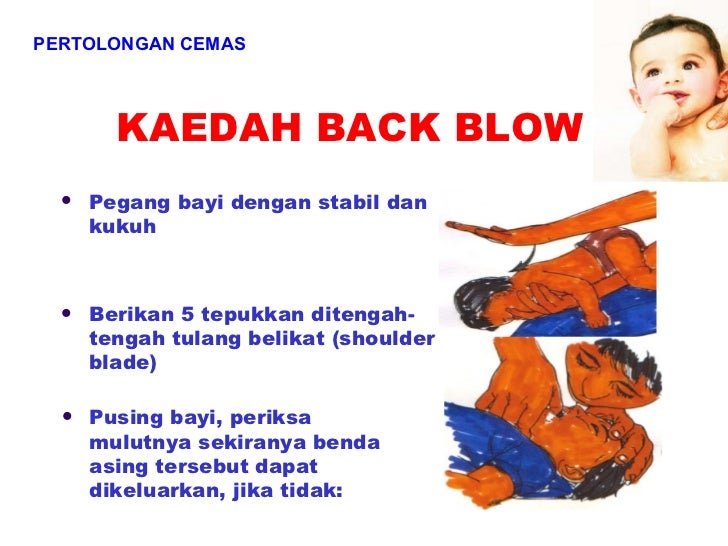 Ceramah bls choking