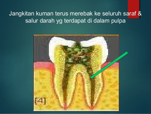 Ceramah gigi sek.men 2018