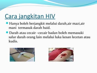 Cara jangkitan HIV
Hanya boleh berjangkit melalui darah,air mazi,air

mani termasuk darah haid.
Darah atau cecair –cecair badan boleh memasuki
salur darah orang lain melalui luka kesan lecetan atau
kudis.

 