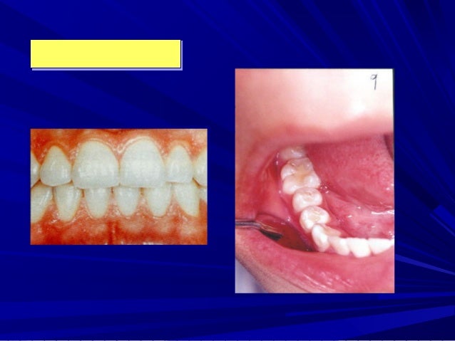 Ceramah pergigian tahap 1