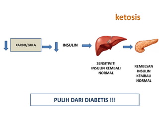 KARBO/GULA INSULIN
SENSITIVITI
INSULIN KEMBALI
NORMAL
REMBESAN
INSULIN
KEMBALI
NORMAL
PULIH DARI DIABETIS !!!
 