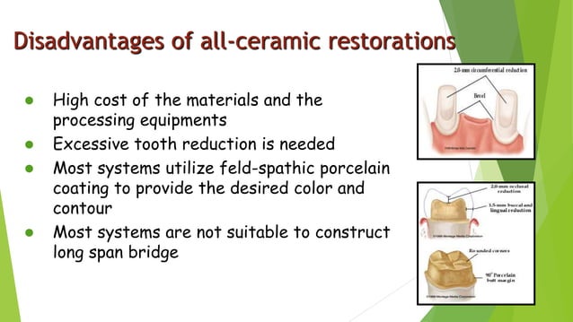 Dental Ceramics and Porcelain fused to metal | PPTX