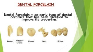 Dental Ceramics and Porcelain fused to metal | PPTX