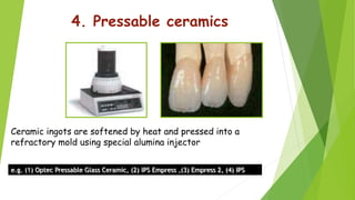 Dental Ceramics and Porcelain fused to metal | PPTX