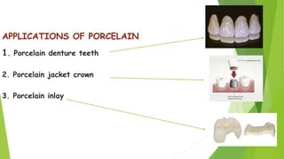Dental Ceramics and Porcelain fused to metal | PPTX