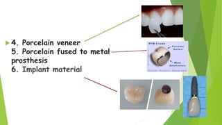 Dental Ceramics and Porcelain fused to metal | PPTX