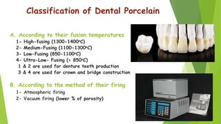 Dental Ceramics and Porcelain fused to metal | PPTX