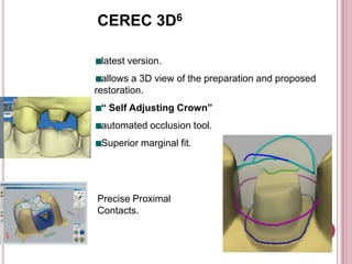 CEREC 3D6

 latest version.
  allows a 3D view of the preparation and proposed
restoration.
 “ Self Adjusting Crown”
 automated occlusion tool.
 Superior marginal fit.




Precise Proximal
Contacts.
 