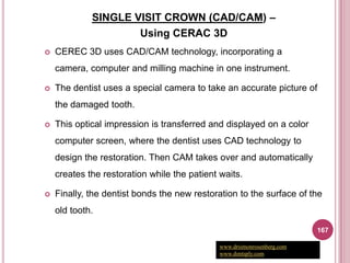 SINGLE VISIT CROWN (CAD/CAM) –
                     Using CERAC 3D
   CEREC 3D uses CAD/CAM technology, incorporating a
    camera, computer and milling machine in one instrument.

   The dentist uses a special camera to take an accurate picture of
    the damaged tooth.

   This optical impression is transferred and displayed on a color
    computer screen, where the dentist uses CAD technology to
    design the restoration. Then CAM takes over and automatically
    creates the restoration while the patient waits.

   Finally, the dentist bonds the new restoration to the surface of the
    old tooth.

                                                                         167

                                              www.drsimonrosenberg.com
                                              www.dentsply.com
 