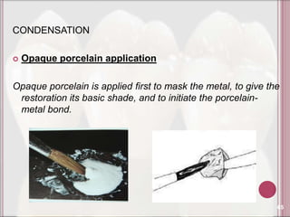 CONDENSATION

   Opaque porcelain application

Opaque porcelain is applied first to mask the metal, to give the
 restoration its basic shade, and to initiate the porcelain-
 metal bond.




                                                               65
 