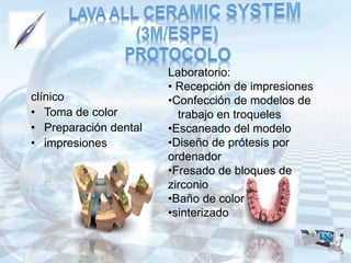 Ceramicas dentales