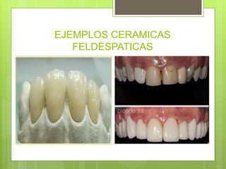 EJEMPLOS CERAMICAS
FELDESPATICAS
 