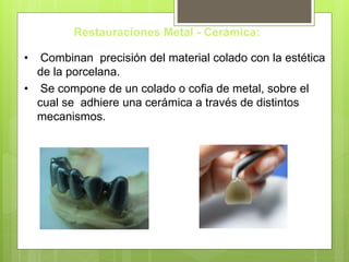 Restauraciones Metal - Cerámica:
• Combinan precisión del material colado con la estética
de la porcelana.
• Se compone de un colado o cofia de metal, sobre el
cual se adhiere una cerámica a través de distintos
mecanismos.
 