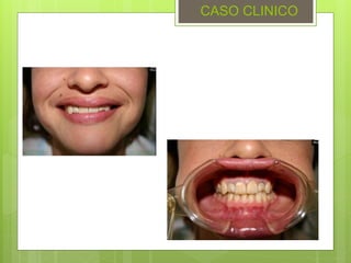 CASO CLINICO
 
