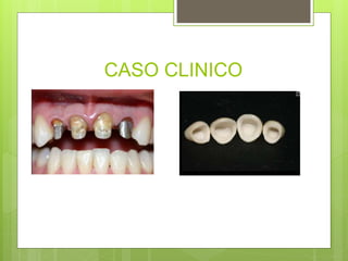CASO CLINICO
 