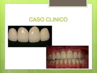 CASO CLINICO
 