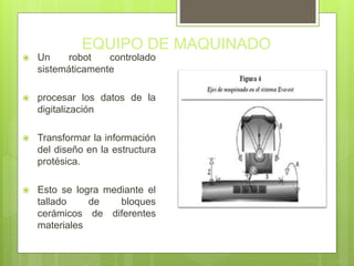 EQUIPO DE MAQUINADO
 Un robot controlado
sistemáticamente
 procesar los datos de la
digitalización
 Transformar la información
del diseño en la estructura
protésica.
 Esto se logra mediante el
tallado de bloques
cerámicos de diferentes
materiales
 