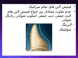 •
‫سرامیک‬ ‫تمام‬ ‫های‬ ‫الین‬ ‫فینیش‬
•
‫های‬ ‫الین‬ ‫فینیش‬ ‫انواع‬ ‫بین‬ ‫معنادار‬ ‫تفاوت‬ ‫عدم‬
‫رادیال‬ ،‫شولدر‬ ‫اسلوپ‬ ،‫چمفر‬ ‫دیپ‬ ،‫چمفر‬ ‫الیت‬
‫شولدر‬
-
‫الیرینگ‬
-
‫منولیتیک‬
 