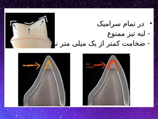 •
‫سرامیک‬ ‫تمام‬ ‫در‬
-
‫ممنوع‬ ‫تیز‬ ‫لبه‬
-
‫نداریم‬ ‫متر‬ ‫میلی‬ ‫یک‬ ‫از‬ ‫کمتر‬ ‫ضخامت‬
 