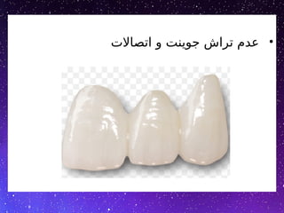 •
‫اتصاالت‬ ‫و‬ ‫جوینت‬ ‫تراش‬ ‫عدم‬
 