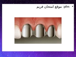 •
pfm
:
‫فریم‬ ‫امتحان‬ ‫موقع‬
 