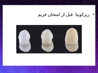 •
:
‫فریم‬ ‫امتحان‬ ‫از‬ ‫قبل‬ ‫زیرکونیا‬
 