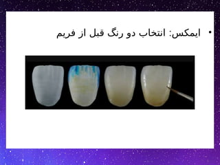 •
:
‫فریم‬ ‫از‬ ‫قبل‬ ‫رنگ‬ ‫دو‬ ‫انتخاب‬ ‫ایمکس‬
 