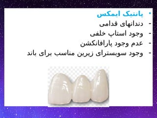 •
‫ایمکس‬ ‫پانتیک‬
-
‫قدامی‬ ‫دندانهای‬
-
‫خلفی‬ ‫استاپ‬ ‫وجود‬
-
‫پارافانکشن‬ ‫وجود‬ ‫عدم‬
-
‫باند‬ ‫برای‬ ‫مناسب‬ ‫زیرین‬ ‫سوبسترای‬ ‫وجود‬
 