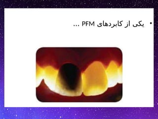 •
‫کابردهای‬ ‫از‬ ‫یکی‬
PFM
...
 