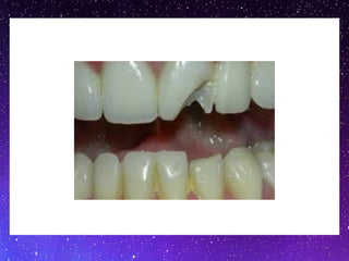 ceramicc (1).pptx for Dentistry students