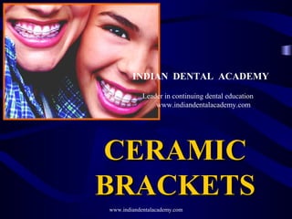 CERAMICCERAMIC
BRACKETSBRACKETS
www.indiandentalacademy.com
INDIAN DENTAL ACADEMY
Leader in continuing dental education
www.indiandentalacademy.com
 