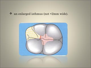  an enlarged isthmus (not <2mm wide).

 