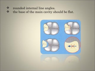 


rounded internal line angles.
the base of the main cavity should be flat.

 
