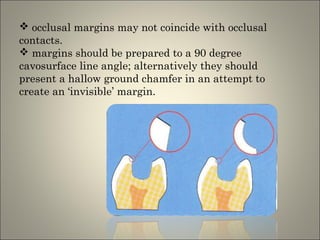  occlusal margins may not coincide with occlusal
contacts.
 margins should be prepared to a 90 degree
cavosurface line angle; alternatively they should
present a hallow ground chamfer in an attempt to
create an ‘invisible’ margin.

 