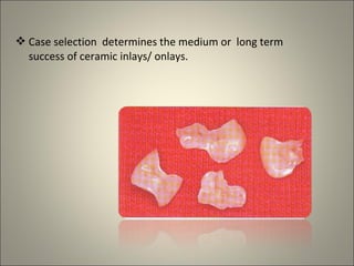 Case selection determines the medium or long term
success of ceramic inlays/ onlays.

 