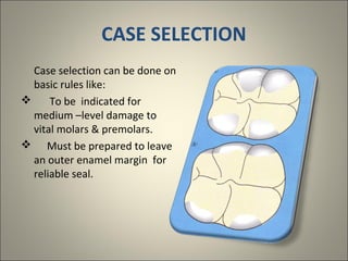 CASE SELECTION
Case selection can be done on
basic rules like:

To be indicated for
medium –level damage to
vital molars & premolars.
 Must be prepared to leave
an outer enamel margin for
reliable seal.

 