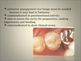  extensive unsupported over hangs must be avoided
because it may lead to fractures.
 contraindicated in parafunctional activity.
 ease to access the cavity for preparation, making
impressions and bonding.
 contraindicated in short clinical crown.

 