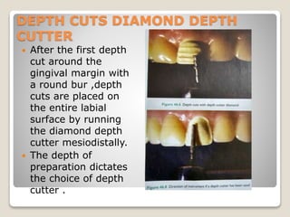 CERAMIC LAMINATE VENEERS.pptx