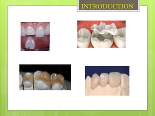 power point on dental ceramics along with cad cam | PPTX